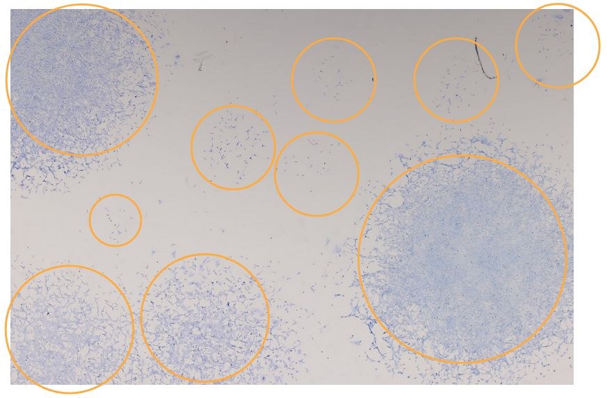 Giemsa-stained fibroblast colonies from prototype scans